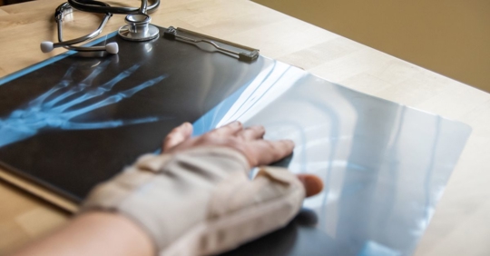 injured worker with x-ray of hand on the table
